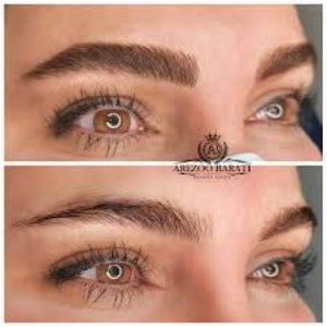 arezoopari fibroz salon (1) سالن فیبروز آرزو پری - بهترین سالن فیبروز ابرو در تهران