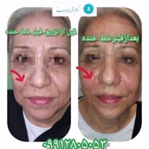 dr bohrani ozon clinic (3) کلینیک دکتر بحرانی بهترین سالن اوزون تراپی در تهران