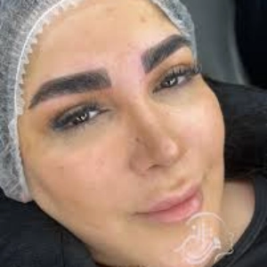 farzane mohammadpour fibroz salon (2) سالن فیبروز فرزانه محمدپور - بهترین سالن فیبروز ابرو در تهران