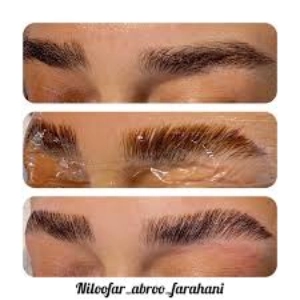niloo farahani fibroz salon (4) سالن فیبروز نیلوفر فرهانی - بهترین سالن فیبروز ابرو در تهران