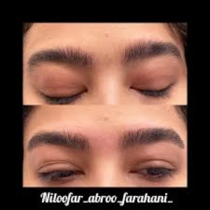 niloo farahani fibroz salon (5) سالن فیبروز نیلوفر فرهانی - بهترین سالن فیبروز ابرو در تهران