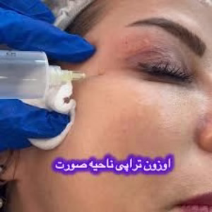 ozonic clinic (3) کلینیک اوزونیک بهترین سالن اوزون تراپی در تهران
