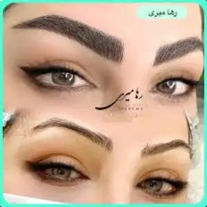 raha miri fibroz salon (2) سالن فیبروز رها میری - بهترین سالن فیبروز ابرو در تهران