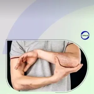 Ali tarat Ozone therapy center مرکز اوزون تراپی دکتر علی تارات بهترین سالن اوزون تراپی در جنوب تهران