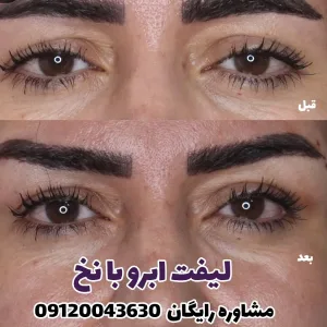 Elahieh eyelash and eyebrow lamination and lift salon (1) سالن لیفت و لمینت مژه و ابرو الهیه بهترین سالن لیفت و لمینت مژه و ابرو در تهران