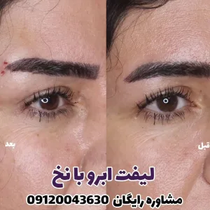 Elahieh eyelash and eyebrow lamination and lift salon (2) سالن لیفت و لمینت مژه و ابرو الهیه بهترین سالن لیفت و لمینت مژه و ابرو در تهران