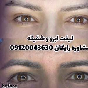 Elahieh eyelash and eyebrow lamination and lift salon (3) سالن لیفت و لمینت مژه و ابرو الهیه بهترین سالن لیفت و لمینت مژه و ابرو در تهران