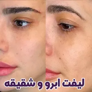Elahieh eyelash and eyebrow lamination and lift salon (4) سالن لیفت و لمینت مژه و ابرو الهیه بهترین سالن لیفت و لمینت مژه و ابرو در تهران
