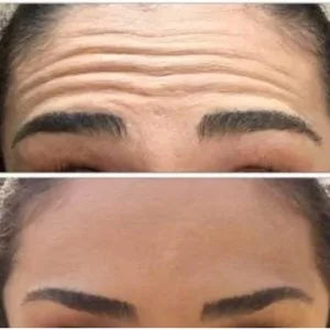 Mohammad jafari Ozone therapy center (1) مرکز اوزون تراپی محمد جعفری بهترین سالن اوزون تراپی در جنوب تهران