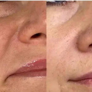 Mohammad jafari Ozone therapy center مرکز اوزون تراپی محمد جعفری بهترین سالن اوزون تراپی در جنوب تهران