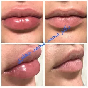 Mohammad jafari Ozone therapy center (4) مرکز اوزون تراپی محمد جعفری بهترین سالن اوزون تراپی در جنوب تهران