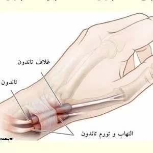 Nasiri Varzaghani Ozone therapy Salon سالن دکتر نصیری ورزقانی بهترین سالن اوزون تراپی در جنوب تهران