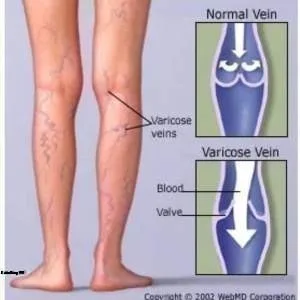Nasiri Varzaghani Ozone therapy Salon (4) سالن دکتر نصیری ورزقانی بهترین سالن اوزون تراپی در جنوب تهران