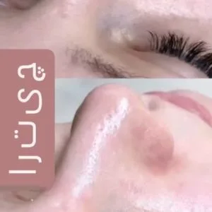 chitra Waxing Salon (3) سالن اپیلاسیون چیترا بهترین سالن اپیلاسیون در غرب تهران