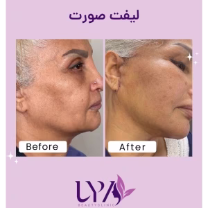 lya ficial center (1) سالن فشیال صورت لیا بهترین سالن فشیال صورت در غرب تهران