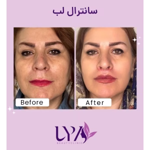 lya ficial center (2) سالن فشیال صورت لیا بهترین سالن فشیال صورت در غرب تهران