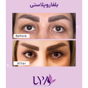 lya ficial center (4) سالن فشیال صورت لیا بهترین سالن فشیال صورت در غرب تهران