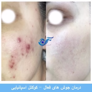 roze abi fecial clinic (2) سالن فشیال صورت لیا بهترین سالن فشیال صورت در غرب تهران
