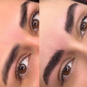 Arezoo Kazemi-Eyebrow-Fibrosis-Salon.4