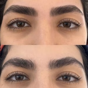 Arezoo Kazemi-Eyebrow-Fibrosis-Salon.5