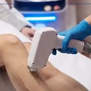 Aban Laser Center3 مرکز لیزر آبان بهترین مرکز لیزر در شیراز
