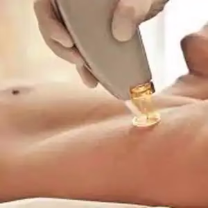 Aban Laser Center4 مرکز لیزر آبان بهترین مرکز لیزر در شیراز