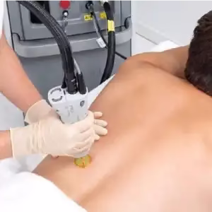 Aram beauty center3 مرکز زیبایی ارم بهترین مرکز لیزر در شیراز
