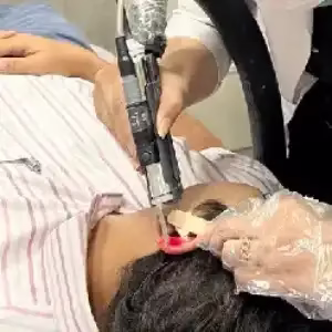 Arian laser center1 مرکز لیزر آریان بهترین مرکز لیزر در شیراز