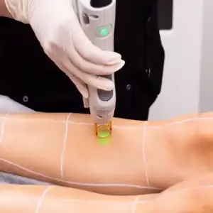 Arian laser center2 مرکز لیزر آریان بهترین مرکز لیزر در شیراز