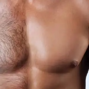 Arian laser center5 مرکز لیزر آریان بهترین مرکز لیزر در شیراز