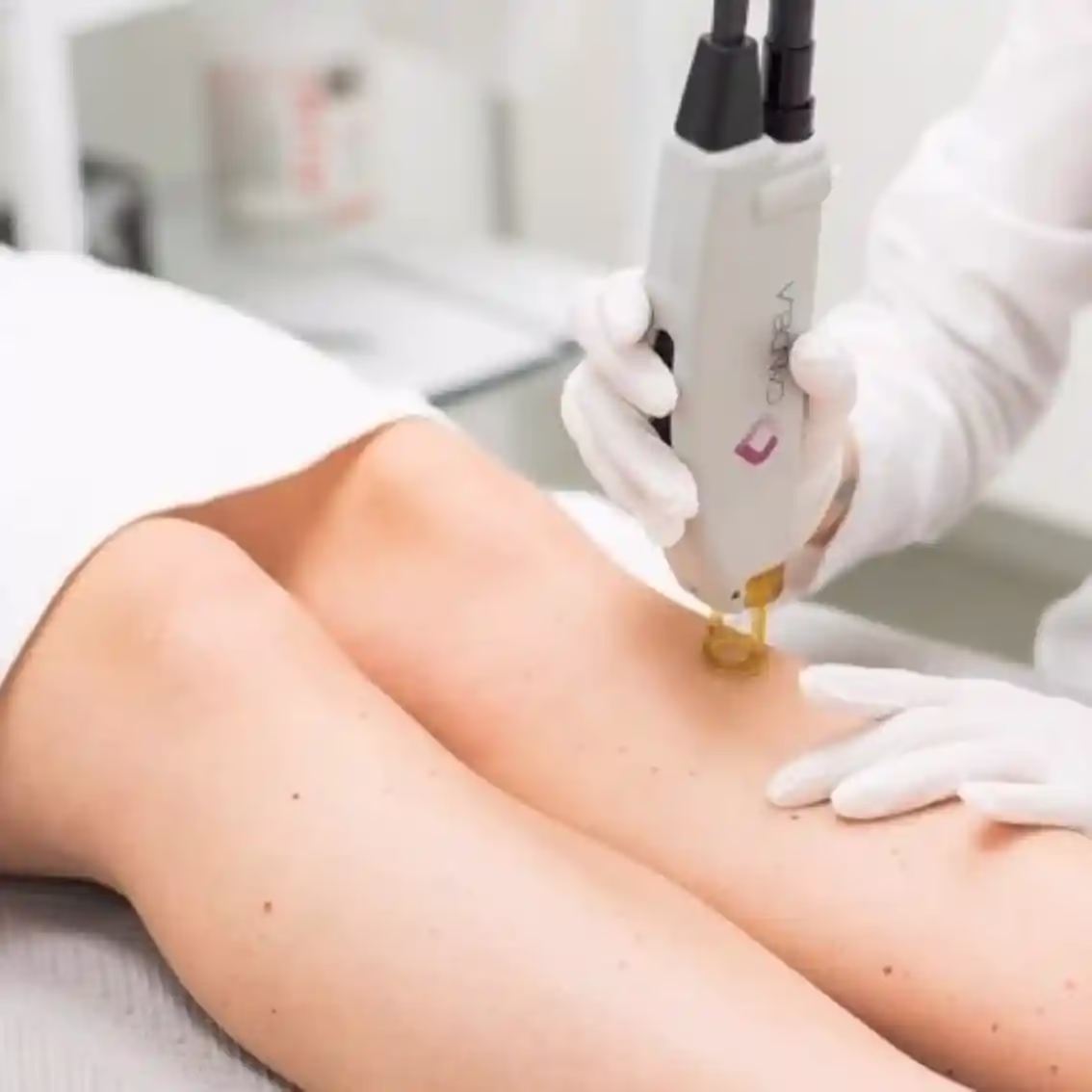 Dr. Sahar Parsai laser center3 مرکز لیزر دکتر سحر پارسایی بهترین مرکز لیزر در مشهد