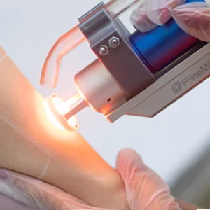 Dr. Sepideh Saadati laser center4 مرکز لیزر دکتر سپیده سعادتی بهترین مرکز لیزر در اصفهان