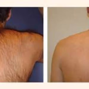 Hera laser center1 مرکز لیزر هرا بهترین مرکز لیزر در اصفهان