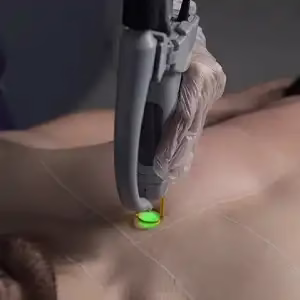Parse laser center2 مرکز لیزر پارسه بهترین مرکز لیزر در شیراز