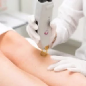 VIP laser center1 مرکز لیزر وی آی پی بهترین مرکز لیزر در اصفهان