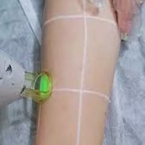 VIP laser center2 مرکز لیزر وی آی پی بهترین مرکز لیزر در اصفهان