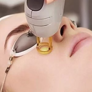 VIP laser center5 مرکز لیزر وی آی پی بهترین مرکز لیزر در اصفهان