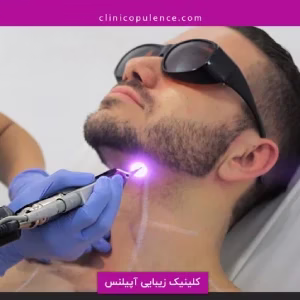 markz lizar apilens2 مرکز لیزر آپیلنس بهترین مرکز لیزر در کرج