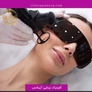 markz lizar apilens4 مرکز لیزر آپیلنس بهترین مرکز لیزر در کرج