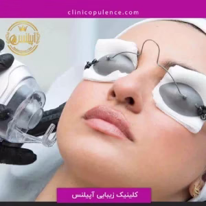 markz lizar apilens5 مرکز لیزر آپیلنس بهترین مرکز لیزر در کرج