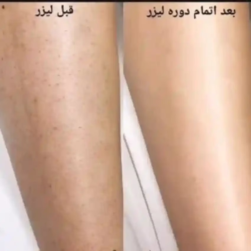 markz lizar eskandri2 مرکز لیزر اسکندری بهترین مرکز لیزر در مشهد