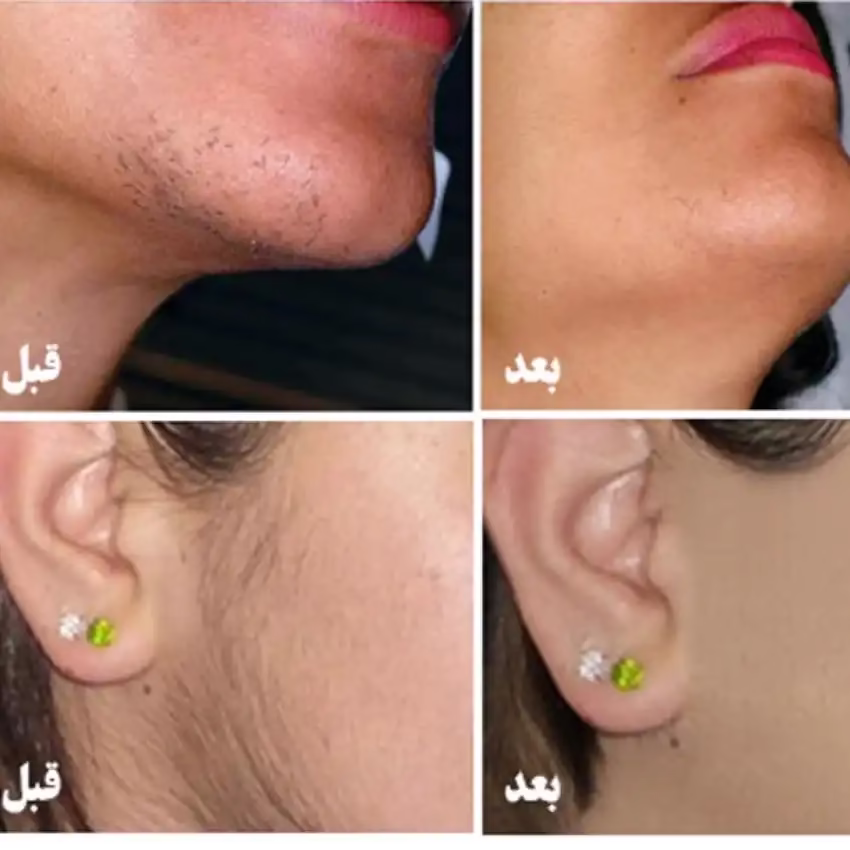 markz lizar eskandri4 مرکز لیزر اسکندری بهترین مرکز لیزر در مشهد