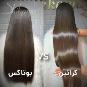 سالن بوتاکس شیکاما- بهترین مرکز بوتاکس مو در تهران