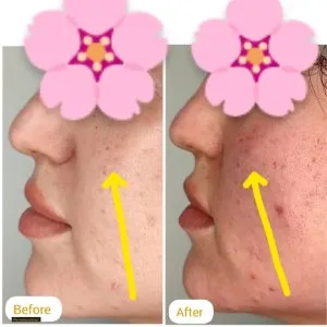 Dr. Saadati Lip Filler Injection Center (2) مرکز تزریق فیلر لب دکتر سعادتی بهترین مرکز تزریق فیلر لب در اصفهان