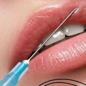 Karma Lip gel injection center (2) مرکز تزریق ژل لب کارما بهترین مرکز تزریق ژل لب در اصفهان