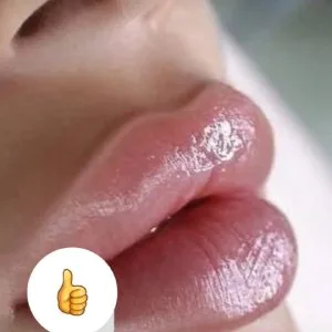 Karma Lip gel injection center مرکز تزریق ژل لب کارما بهترین مرکز تزریق ژل لب در اصفهان