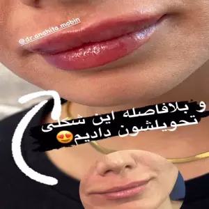 dr.anahita.mobin3