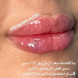 dr.anahita.mobin4