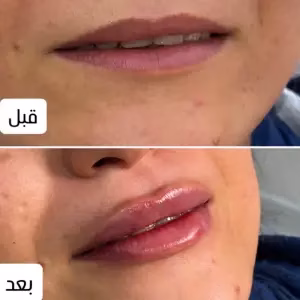 dr.mahsaderakhshani2