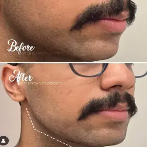 dr.shahram_ghasemzade2